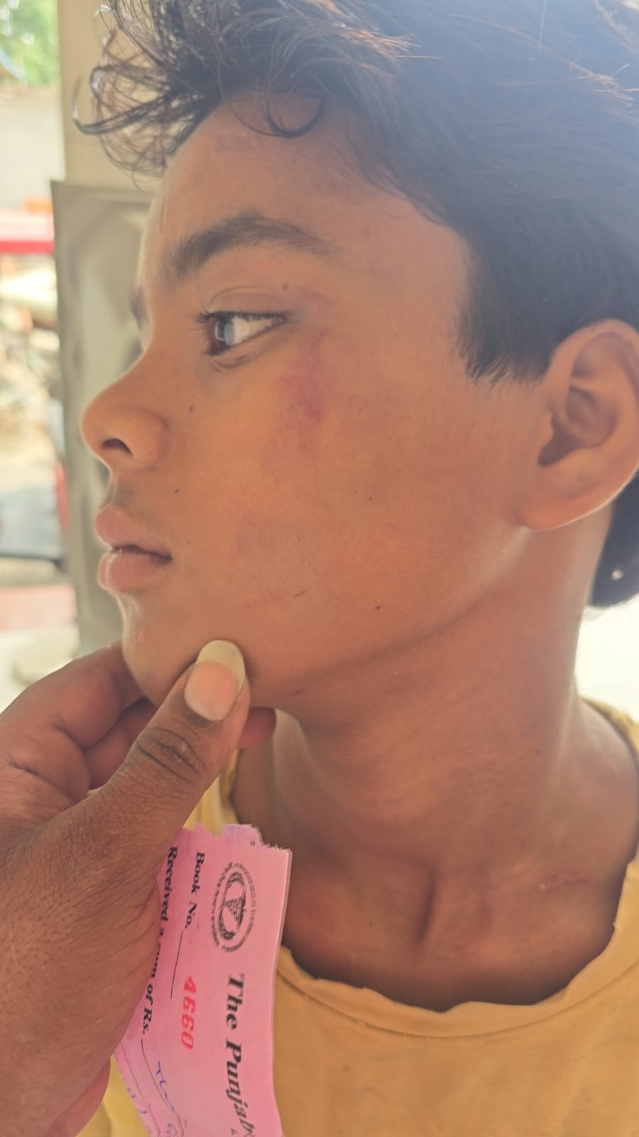 13 ਸਾਲ ਦੇ ਮਾਸੂਮ ‘ਤੇ ਨਸ਼ਾ ਵੇਚਣ ਦੇ ਝੂਠੇ ਇਲਜ਼ਾਮ: ਸ਼ਰਾਬੀ ਤੱਤਾਂ ਨੇ ਗਾਹਲੀ ਗਲੋਚ ਰੋਕਣ ’ਤੇ ਕੀਤੀ ਬੇਰਹਿਮੀ ਨਾਲ ਕੁੱਟਮਾਰ